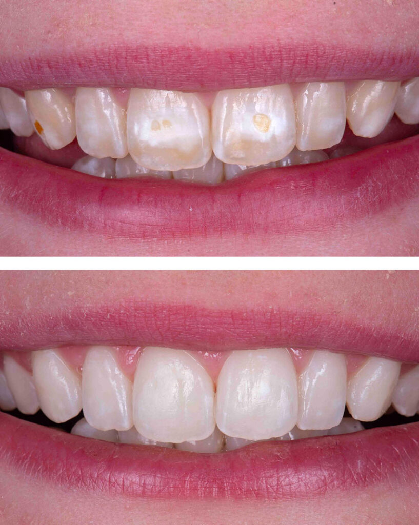 colibri-formation-dentaire-esthetique-ultraconservatrice-1